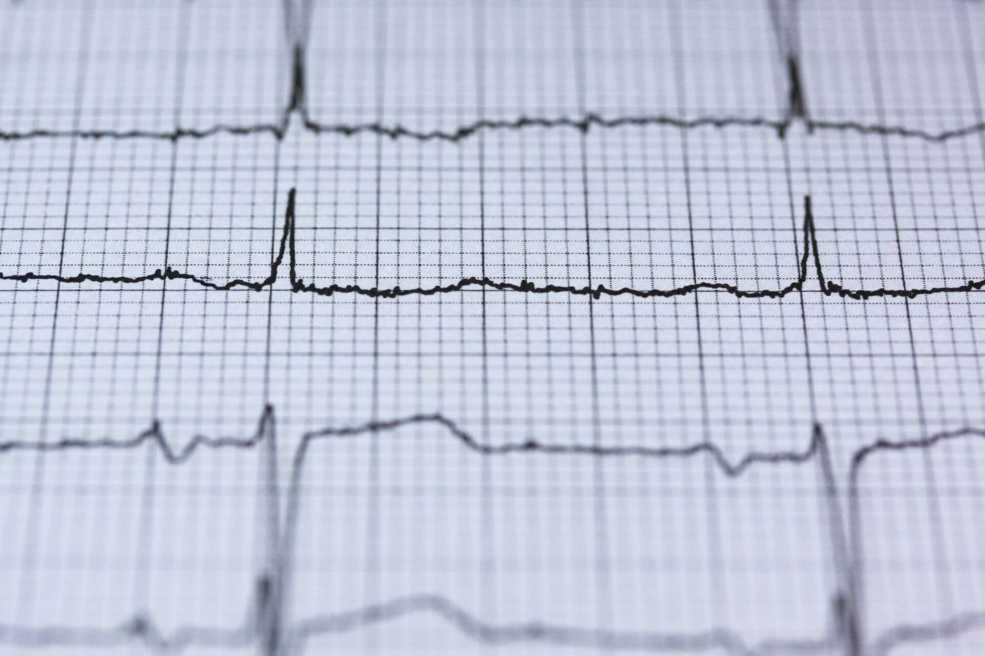 Blur chart check up curve