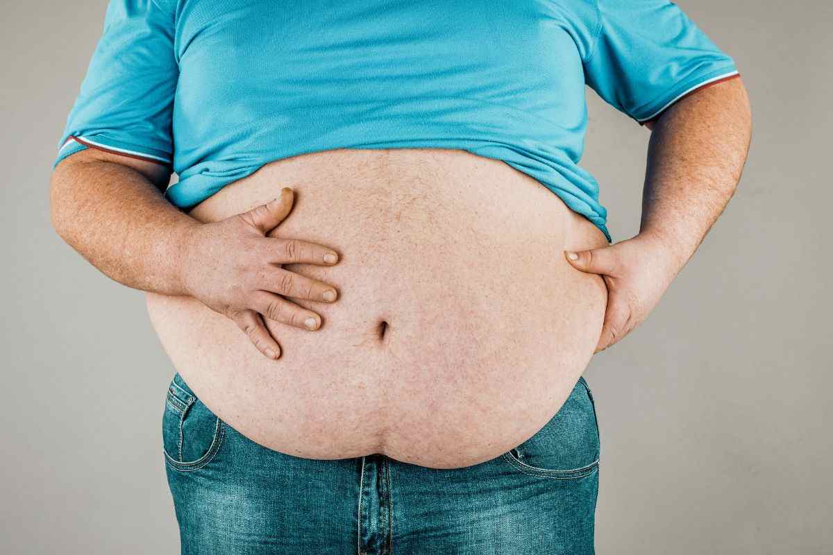 Un significato aumento dell'obesità